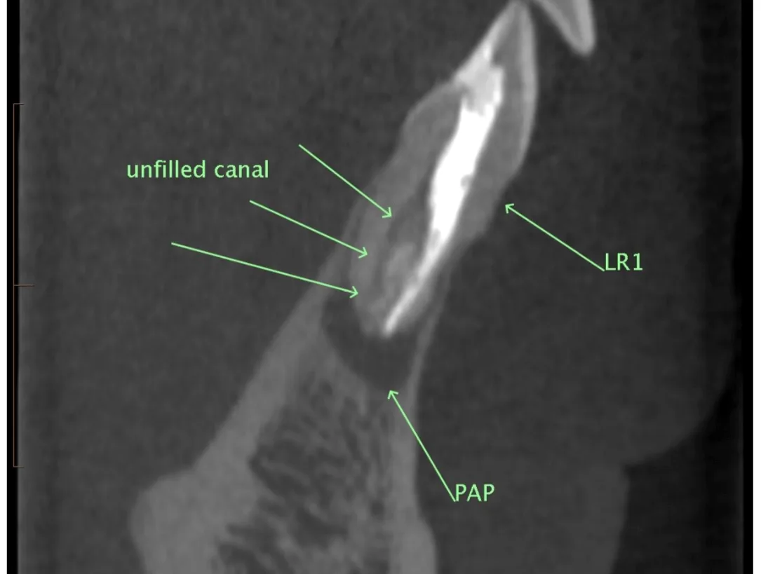 Open demo endo report